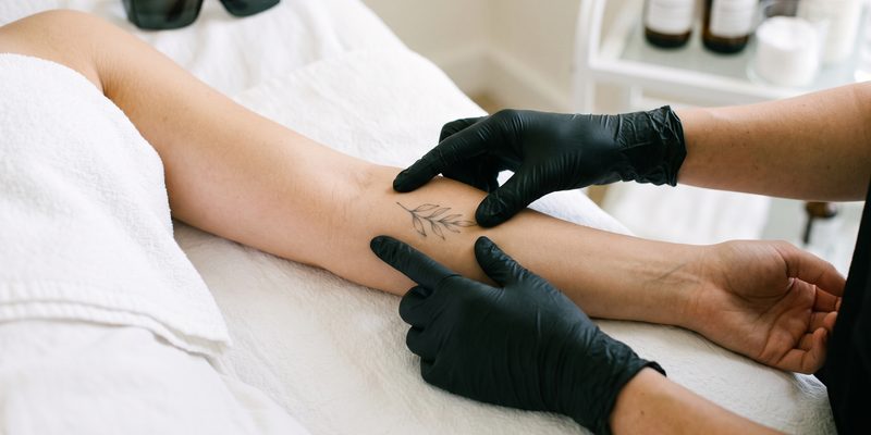 Black-gloved hands stretching the skin either side of a small faded forearm tattoo